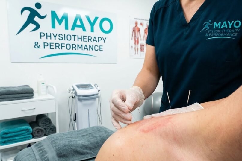 Dry-Needling-Mayo2